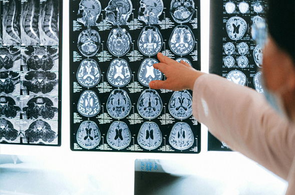 x-rays